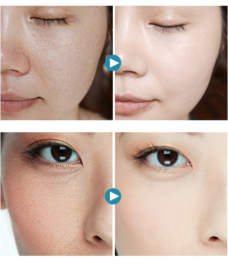 Hyaluronic Acid Shrink Pore Face Serum Hyaluronic Acid Shrink Pore Face Serum